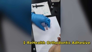 Σύστημα Ορθοδοντικής Συγκόλλησης